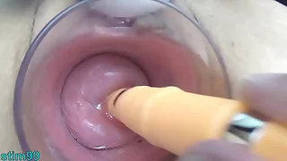 Japanese Milf Cervix Fucking roughly German real penis dildo and asian chopsticks